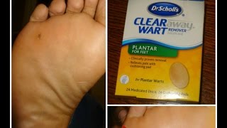 dr scholl's clear away plantar wart remover for feet