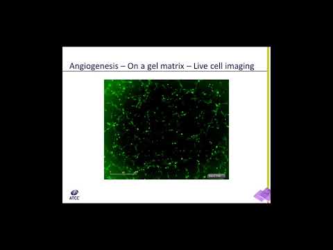 Video: Kekurangan αII-spectrin Menjejaskan Hubungan Sel-matriks Endothelial Dan Migrasi Yang Membawa Kepada Kemerosotan Angiogenesis Secara In Vitro