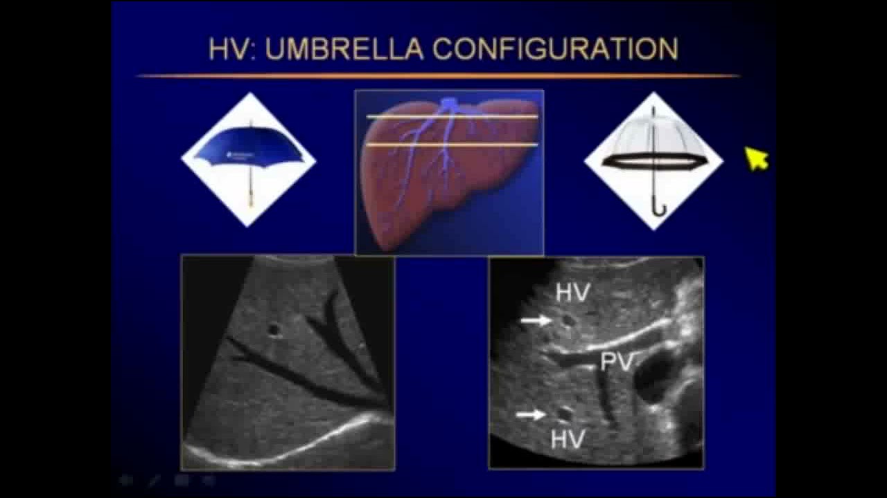 Ultrasound Abdominal pathology