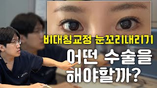 눈 성형, 고민 되시면 사진 보내주세요 - 비대칭, 눈꼬리내리기 어떻게 할까?