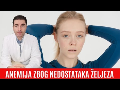 Simptomi ANEMIJE zbog nedostatka ŽELJEZA ( najčešćeg minerala koji nedostaje  ŽENAMA )