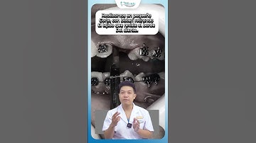 Răng Mọc Ngầm Thì Niềng Răng Như Thế Nào | Nha Khoa Minh Châu