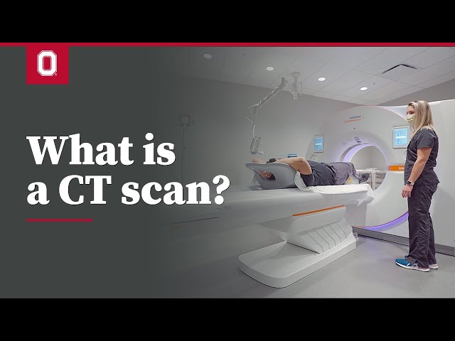 What is a CT scan? | Ohio State Medical Center class=