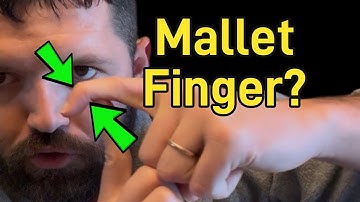 Vinger wil niet recht worden? Negeer deze blessure niet!