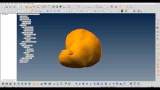 Hallux correction by ThinkDesign + Global shape Modeling