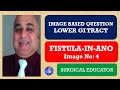 FISTULA IN ANO/ LOWER GI TRACT / Image Based Question