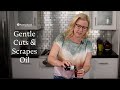 Essential Oil Recipe: Essential Oils for Cuts &amp; Scrapes!