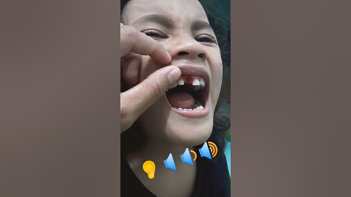 ASMR RUNTUHNYA GIGI SUSU PERTAMA (cek kolom komentar)