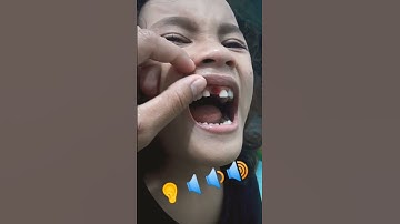 Thumbnail of ASMR RUNTUHNYA GIGI SUSU PERTAMA (cek kolom komentar)