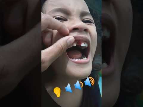 Video: Cara Makan dengan Gigi Gigi: 10 Langkah (dengan Gambar)