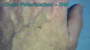 Syris Scientific Headlamp Cross Polarization