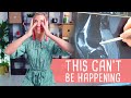 ACL Surgery Update | I Can't Believe It Ft. Mr Adil Ajiued