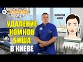 Удаление комков Биша: Как убрать щеки (Видео) Люми-Дент Киев.