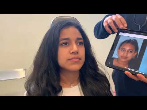 Video thumbnail: Female rhinoplasty for a patient with a hidden columella I  Anthony Bared, MD, FACS I  Miami, FL