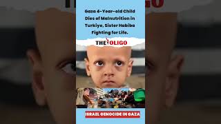 Palestinian Boy Abdullah Abu Dies Due To Malnutrition In Turkiye Hospital After Gaza Hunger Siege.