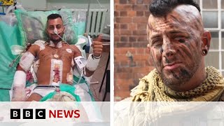 British soldier returns to Ukraine after life-changing injury - BBC News