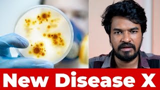 ? Disease X 2023 Explained ️ | Madan Gowri | Latest News Tamil
