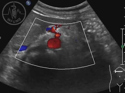 WFUMB Course Book: Abdominal Vessels and Portal Vein System Chaper 11 - video 11.1