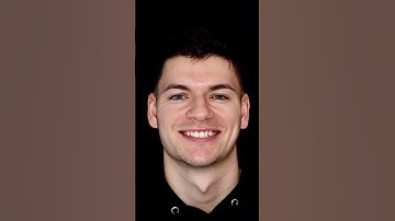 Say hello to our signature ‘ABC’ Smile Makeover! 😀 #invisalign #compositebonding #whitening #smile