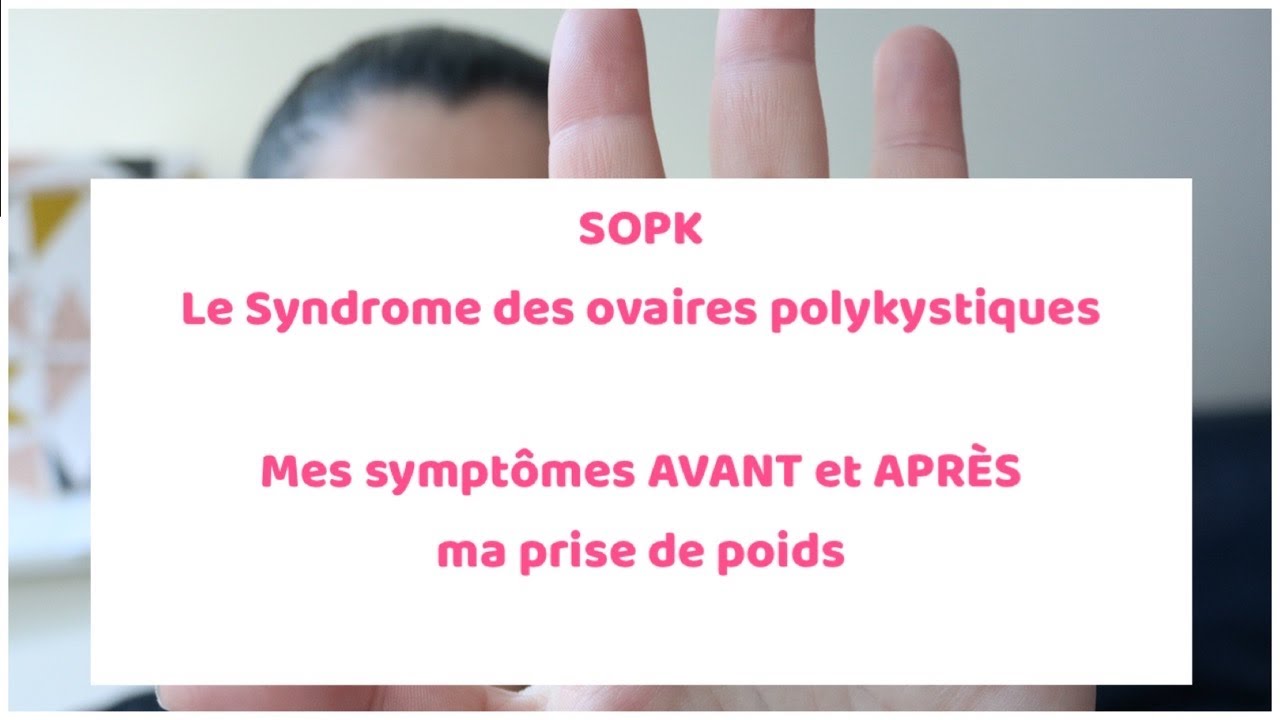 Syndrome des ovaires polykystiques (SOPK) / Mes symptômes AVANT et APRÈS ma  prise de poids