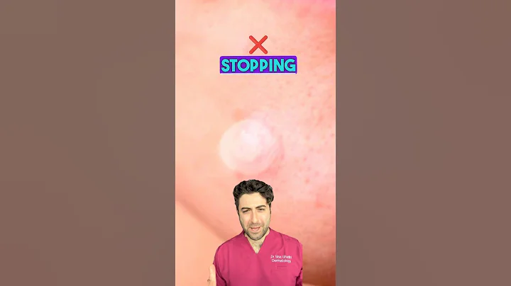 How do PIMPLE PATCHES work?