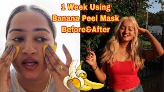 I Rubbed Banana Peel On My Face For 1 Week For Pimples Scars & Hyperpigmentation