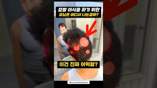 탈모 환자는 어떻게 &#39;치료&#39;해야 할까?