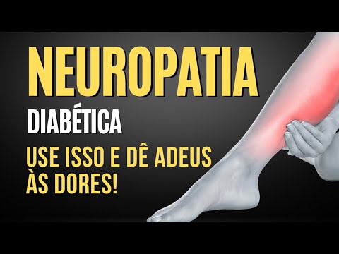 Vídeo: 4 maneiras de lidar com a neuropatia