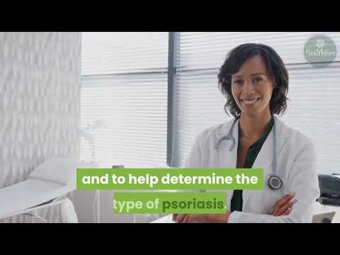 Video: Waar begin guttate psoriase?