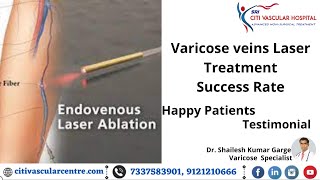 Varicose Veins Laser Treatment Success Rate in Hyderabad | Happy Patients