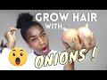 How to Use Onion Juice for Hair Growth 2021 *QUICK VIDEO!!
