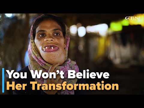 Operation Blessing’s Life-Changing Surgery: Durga’s Incredible Transformation