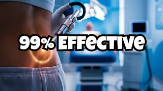 SILAC Pilonidal Cyst Treatment With Laser Technology!