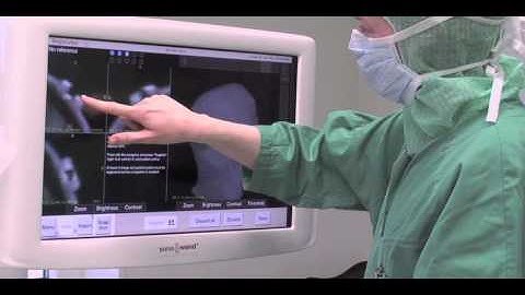 Sonowand-Predictability creates simplicity