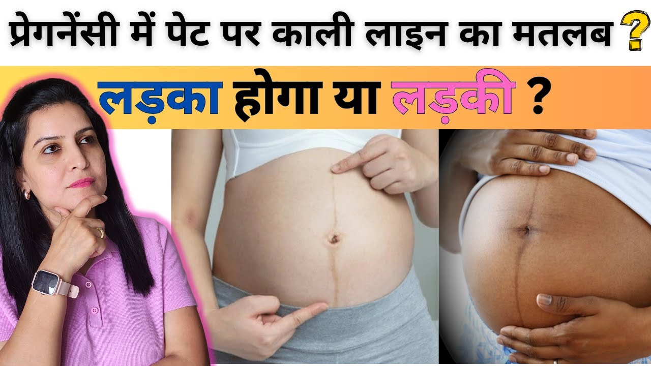 प्रेगनेंसी में पेट पर काली लाइन का मतलब लड़का होगा या लड़की | My Pregnancy Care