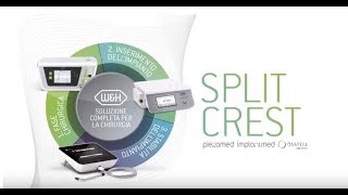 Strumentario per Split Crest - W&H