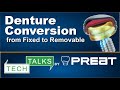 Denture conversion from fixed to removable tech talks by preat