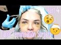 Facial Feminization Surgery - Day 7 & 8 | Stef Sanjati