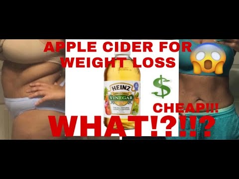 APPLE CIDER VINEGAR WEIGHT LOSS CHALLENGE !!!