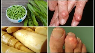 แชร์ด่วน! 33 อาหารต้องห้าม ที่คนเป็นโรคเก๊าท์ ไม่ควรกินเด็ดขาด! (33 Foods To Avoid For Gout)
