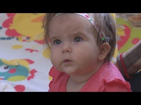 Baby hears for the first time thanks to cochlear implants - YouTube