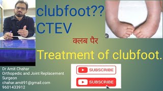 what is clubfoot and how to treat clubfoot/CTEV#bone #clubfoot #foot #pediatrics #orthomedics