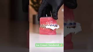 Braces Food Choices : Ice Cream Bars Edition - ASMR - StarxWyd