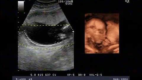 siêu âm 3D-4D Baby THIÊN BÁCH