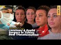 Forehead Reduction &amp; Eyelid Surgery w/ Dr. Cengizhan Ekizceli at Estherian Clinic!