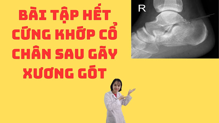 Các bài tập giúp phục hồi chức năng bàn chân năm 2024