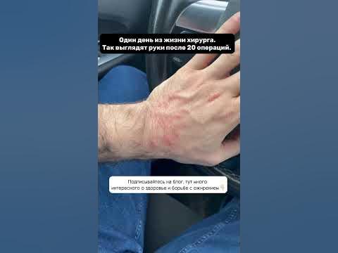 Руки хирурга после 20 операций #хирург #хирургмосква #бариатрия - YouTube
