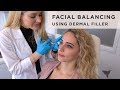 Facial balancing using dermal filler with skin by lovely
