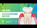 👨‍⚕️ Как лечить воспаление десен?