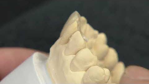 MDT. Hitoshi Aoshima using Cerabien ZR (CZR) for Build-up Technique. Part 5.